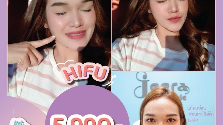 What Are Botox Injections?