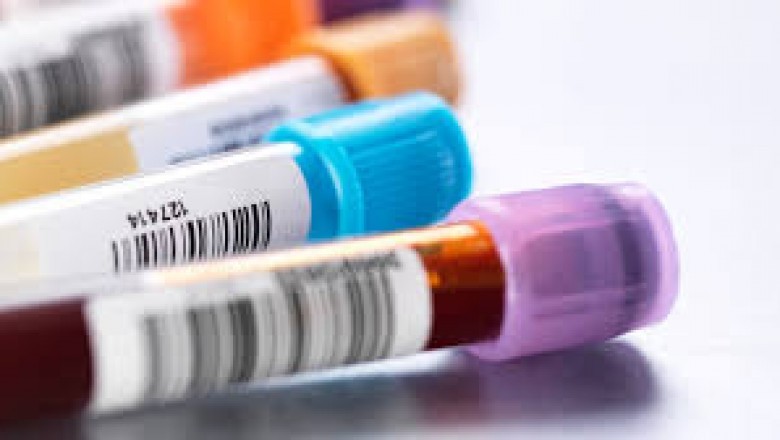Why Is Home STD Test Kits The Best For STD Testing