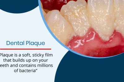 Dental Plaque | 24 Hour Emergency Dentists