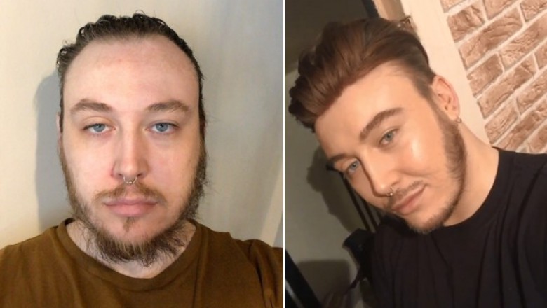 How to deal with oily skin while wearing a men's hair system