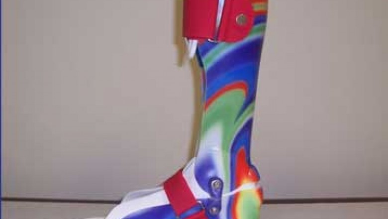 Prosthetics Leesburg VA