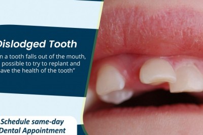 Dislodged Tooth | Emergency Dental Services in United States