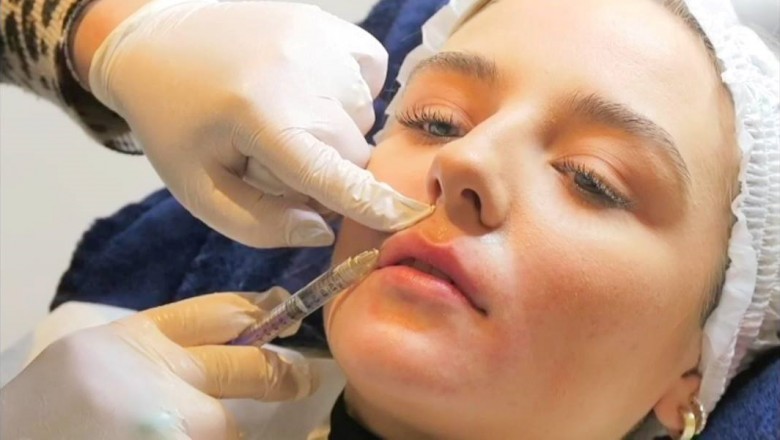 Find the Best Skin Clinic in London for Skin Treatments