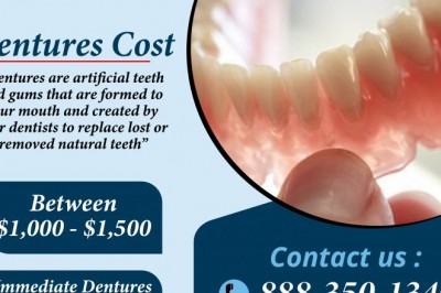 Dentures Cost | Emergency Dental Service