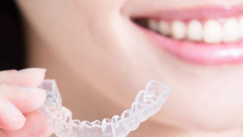 Invisalign in Rockford, IL | Invisalign Clear Braces Rockford, IL, 61107
