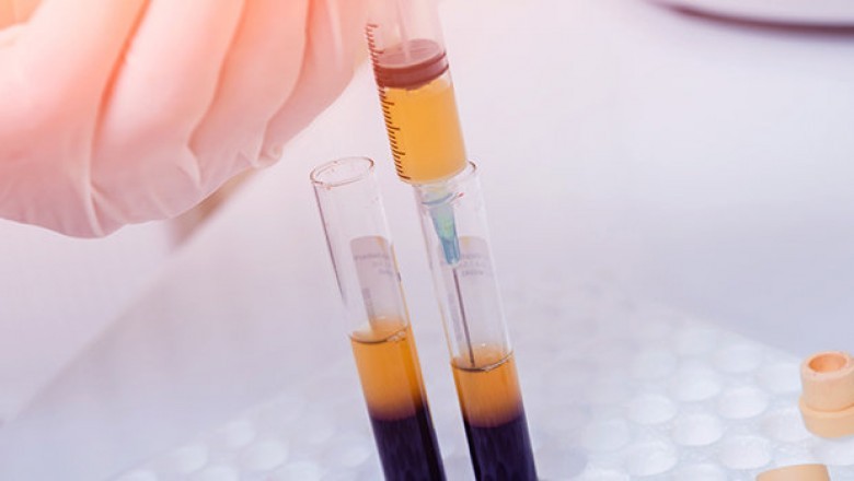 Global Platelet Rich Plasma Market is Witness Massive Surge as U.S.-based Industry Leader Generex Biotechnology Corporation acquires Medisource Partners
