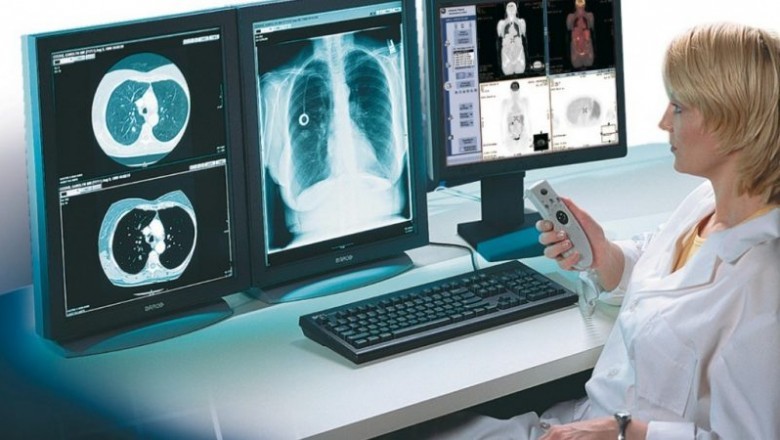 Radiology Information Systems is Enabling Hospitals in Maintaining Critical Medical Imagery and Relevant Data