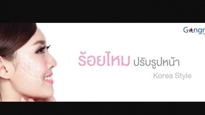 What is the Thread Lift Face Lift