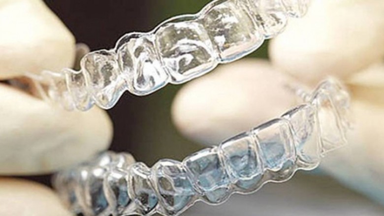Clear Aligners Market To Surpass US$ 7.2 Billion By 2026 - Coherent Market Insights