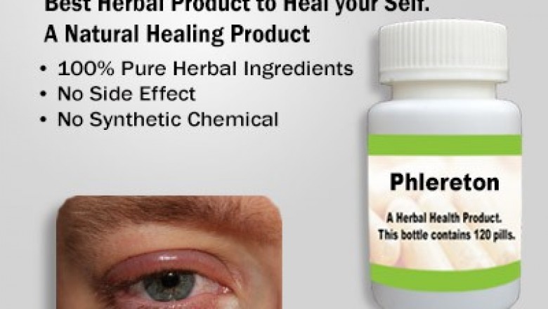 Natural Remedies for Blepharitis Treat with Natural Essential Oils