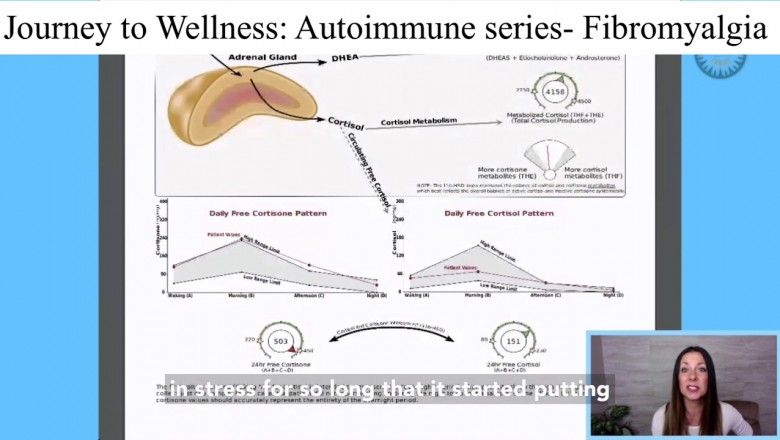 The autoimmune series: Fibromyalgia