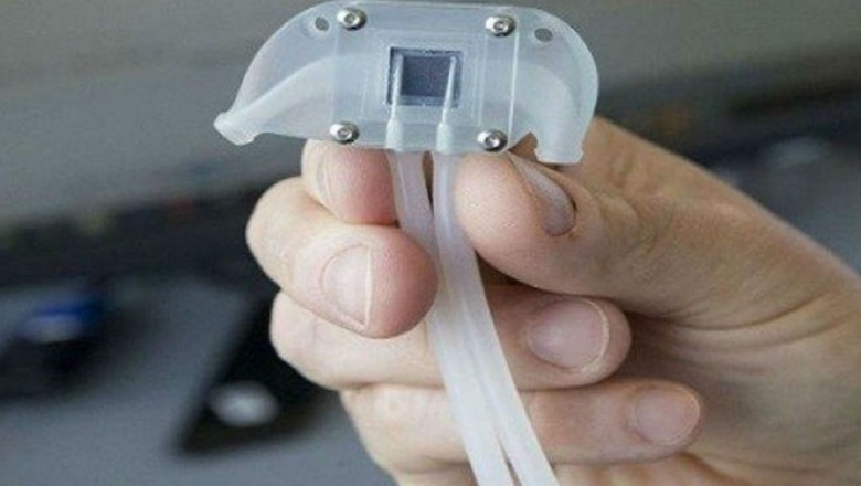 Implantable Bioartificial Kidney Market Opportunity Analysis-2027