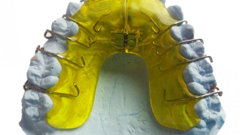 Laboratorio de ortodoncia Úbeda