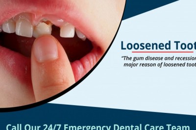 Loosened Tooth Treatment | Urgent Dental Care