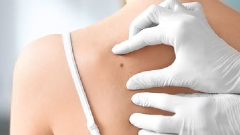 Your one stop solution for all skin concerns