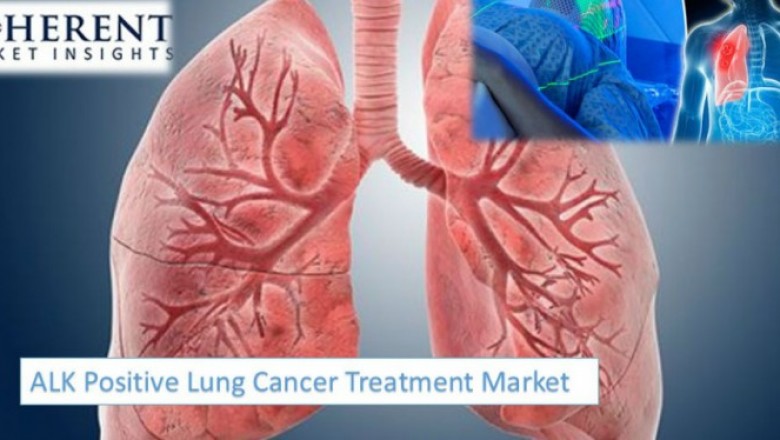 ALK Positive Lung Cancer Treatment Market Opportunity Analysis-2027