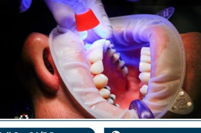 Emergency Dentist in United States for Any type of Pain