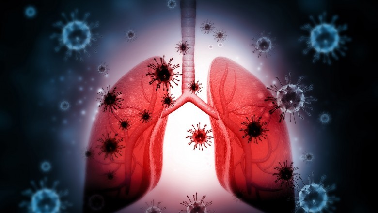 Treatments for respiratory tract infection are used to treat irresistible lower or upper respiratory tract diseases