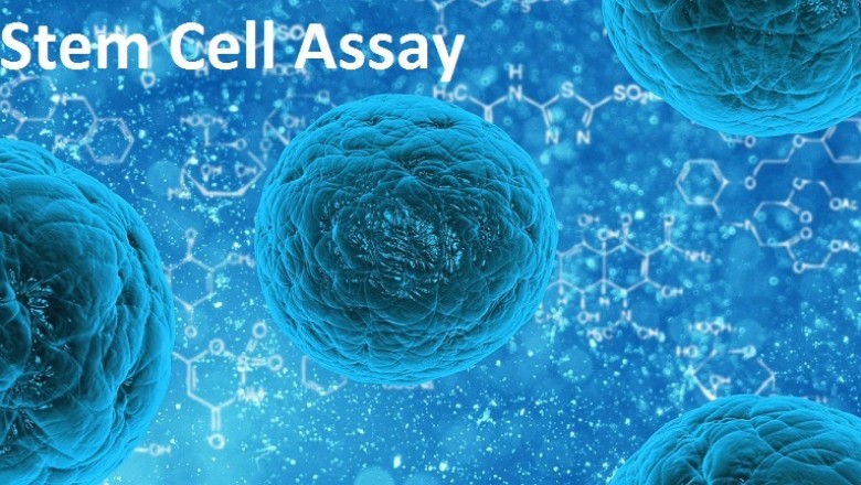 In Advancement of Personalized Medicine and Treatment of Chronic Diseases, Stem Cell Assays may be Important.