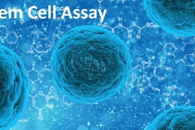In Advancement of Personalized Medicine and  Treatment of Chronic Diseases, Stem Cell Assays may be Important.