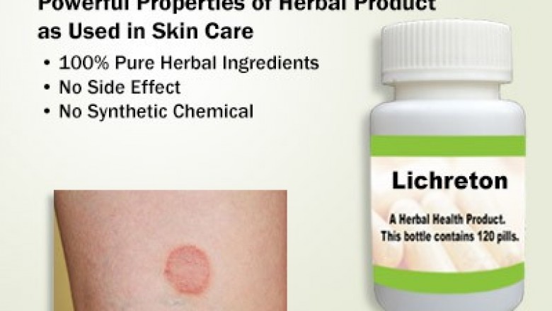 Natural Remedies for Lichen Planus Relieve the Pain Naturally