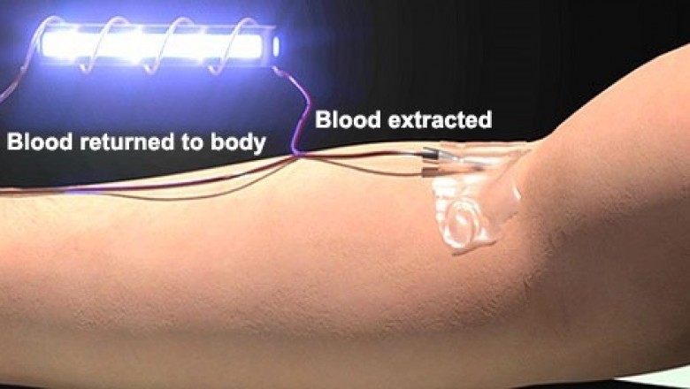 Blood Irradiation Market Size, Share, Outlook, and Opportunity Analysis, 2018– 2026