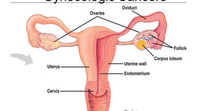 Different companies concentrate on AI-driven, patient-centered R&D platforms for gynecological cancer drugs