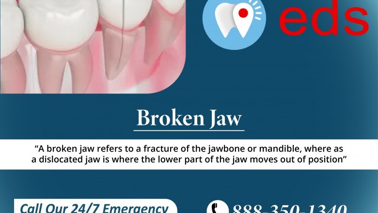 Broken Jaw Treatment | Best Emergency Dentist in United States