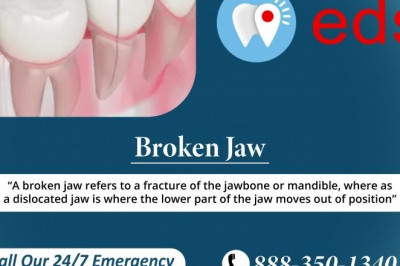 Broken Jaw Treatment | Best Emergency Dentist in United States
