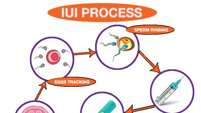 Which One Should You Opt For - IVF Or IUI?