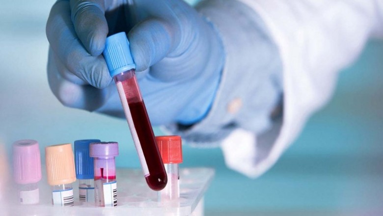 Non-Invasive Cancer Diagnostics Market Size Share Trends Forecast 2026