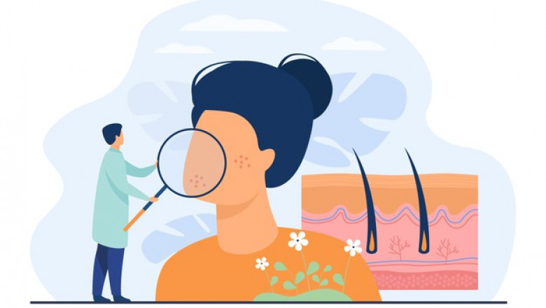 Why Should Consult a Dermatologist for Skin Problems?