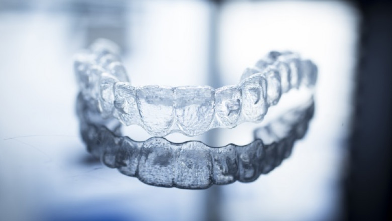 Common Dental Braces Myths That You Wish You Didn't Know