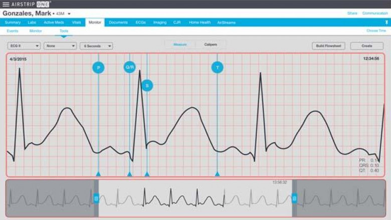 ECG Management Systems Market Size, Trends, Shares, Insights and Forecast – 2018-2026