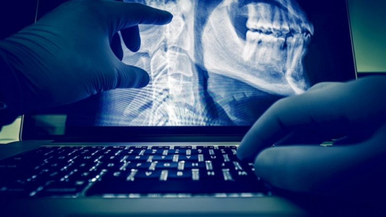 Radiology Information System Market To Surpass US$ 1,620.5 Million By 2027 - Coherent Market Insights