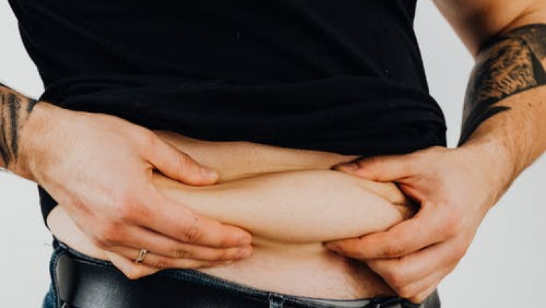 coolsculpting or kybella