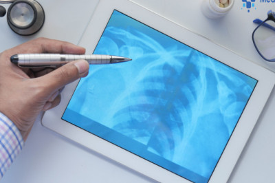 The Power of the Next Generation of RIS | Medicasoft