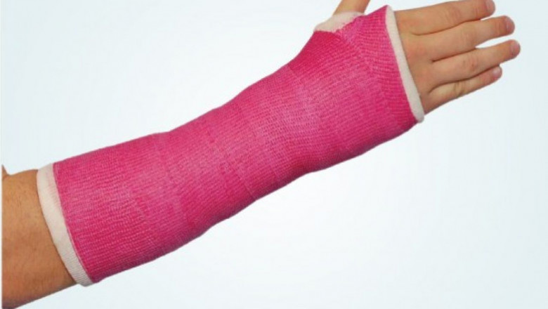 Casting and Splinting Products Market Size Share Trends Forecast 2026