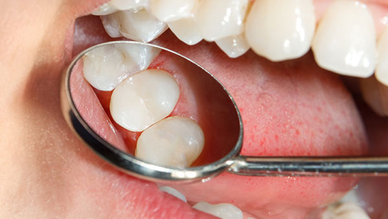 Issues to consider for Discovering a superb Dental Clinic