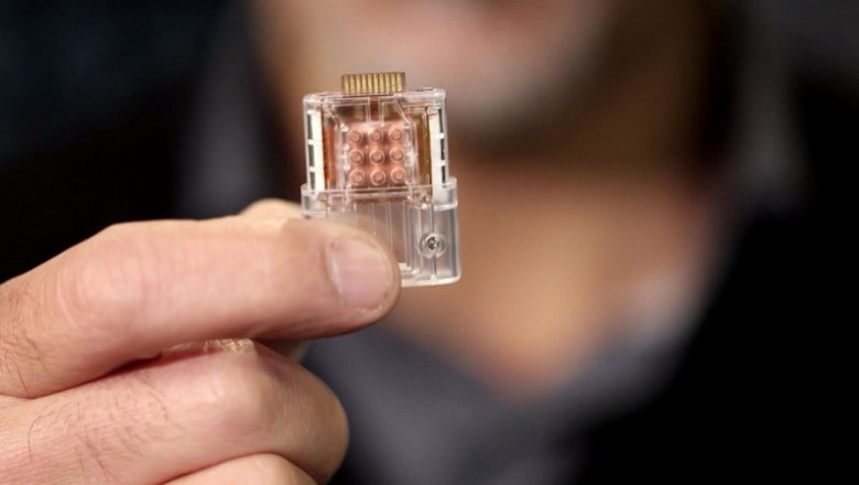 Biochips Market Size, Share, Outlook, and Opportunity Analysis, 2019– 2025