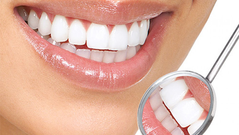 Dental Implants in Cooper City