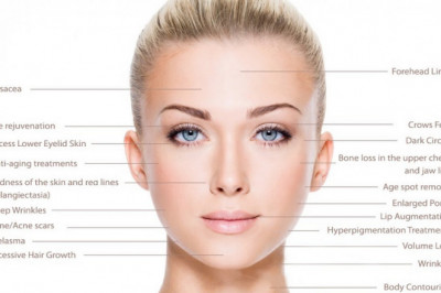 Radiesse Filler London