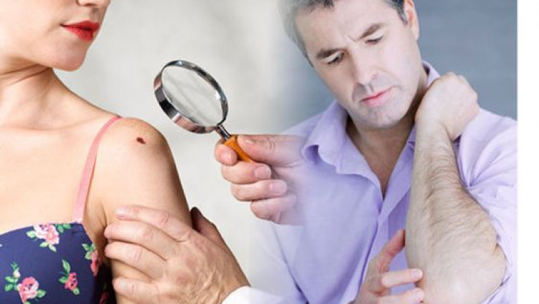 How healthy does your skin feel?