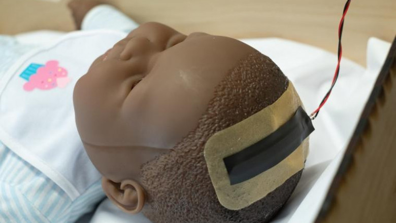 Intracranial Pressure Monitoring Devices Market Opportunity Analysis - 2026