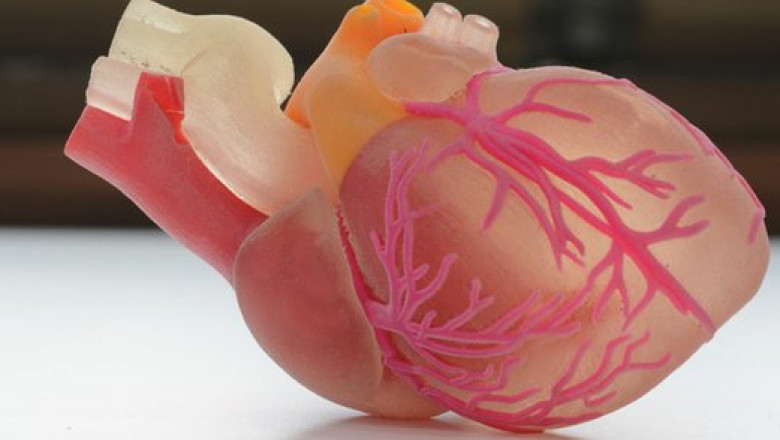 Breast Implants, Surgical Prosthesis Design, Dental Implants, Dentures, Vests, and Body Art all benefit from 3D printing in the medical sector