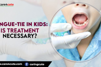 Tongue-tie in Kids: Is Treatment Necessary?