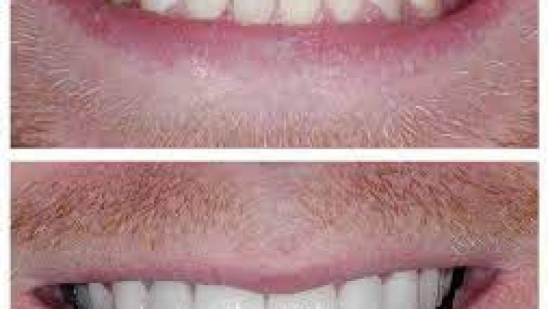 General Dentistry Services