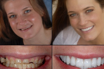 Northern Virginia Orthodontics
