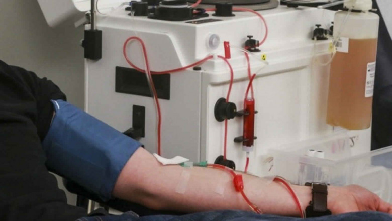Leukapheresis disposable segment is said to dominate the market by revenue