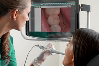 Dental Camera Is A Small Camera That Takes An X-Ray Of The Tooth Or Gums Of Patients